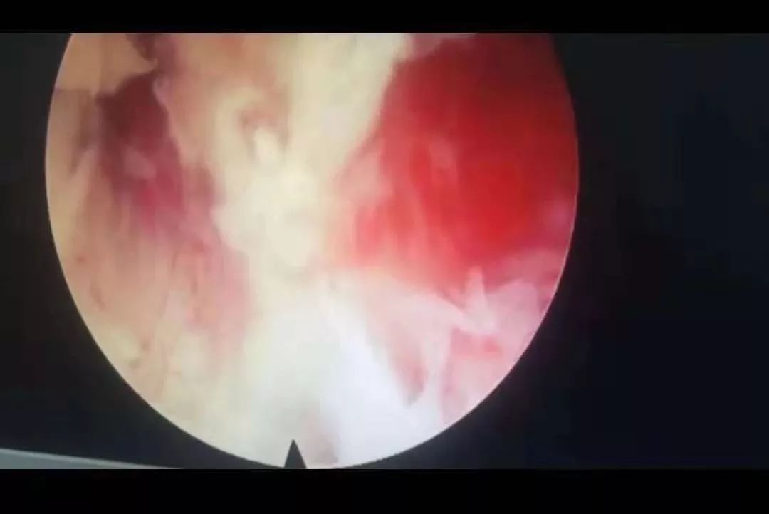 初恋时光动漫 初恋三、时光过程极其搞笑