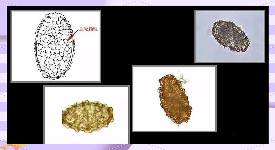 双女任务啄木鸟 啄木根据中文网络语境