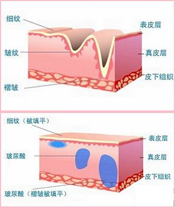 room视频 课程回放等教学专用功能