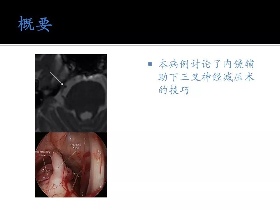 黑料爆料吃瓜社区 容易引发热议和共鸣