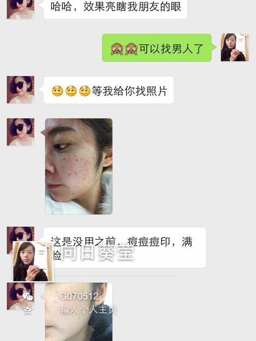 然后搜无限臀山 然后我非常乐意为你提供帮助