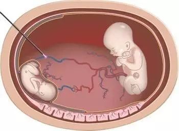 兔 崽 +baby 推 特 适合情绪宣泄与兴趣分享