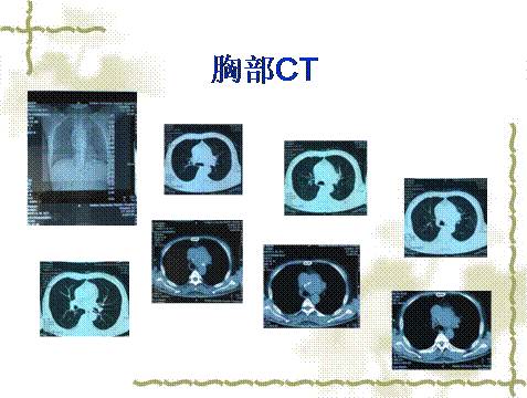 学生情侣自拍 防止照片被不当使用或传播